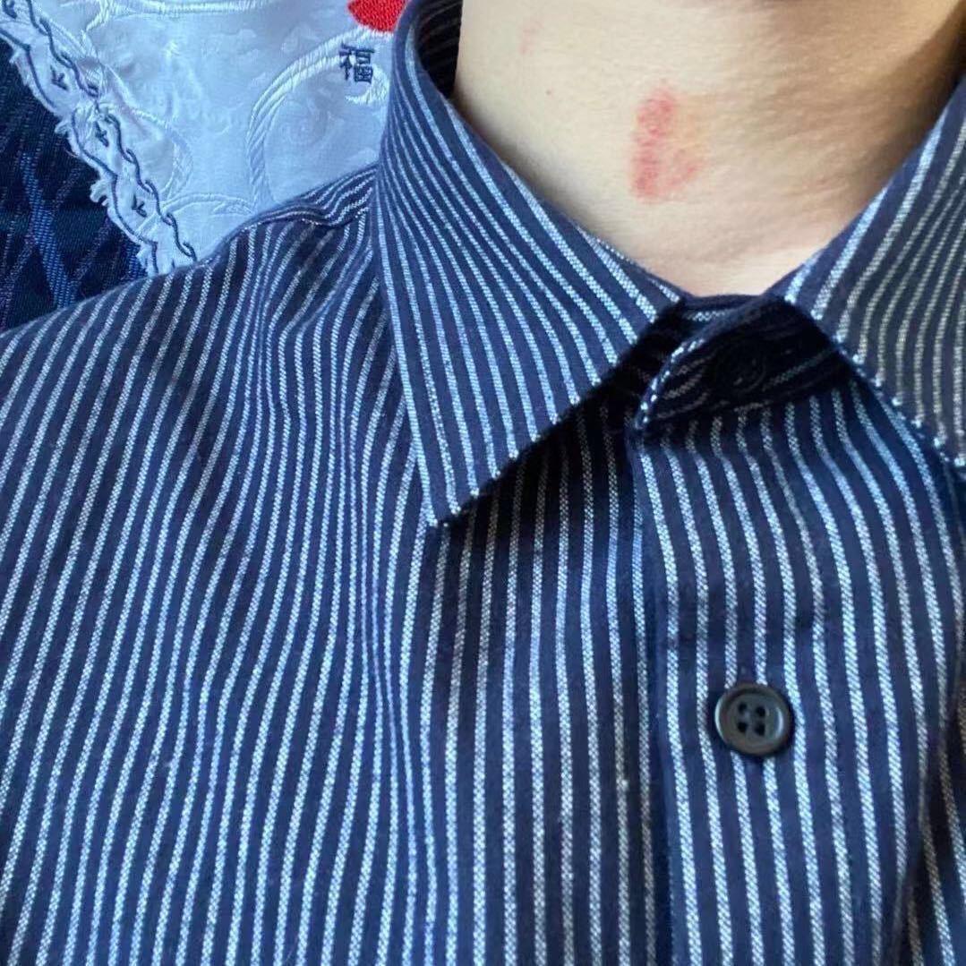 小🦐米