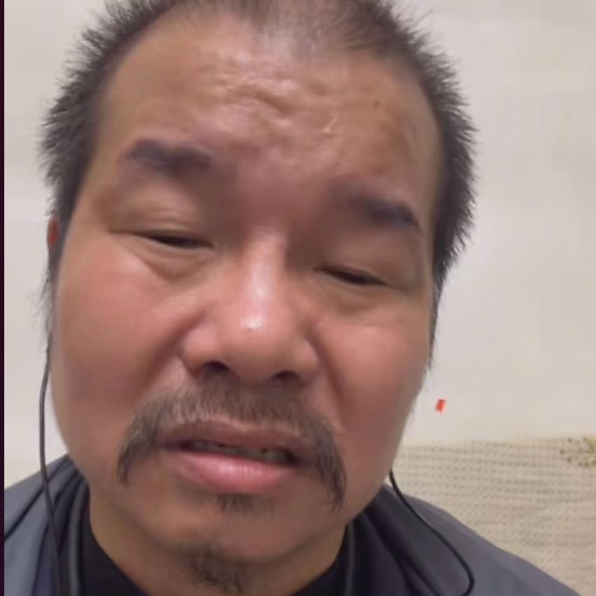 缺牙哥小号