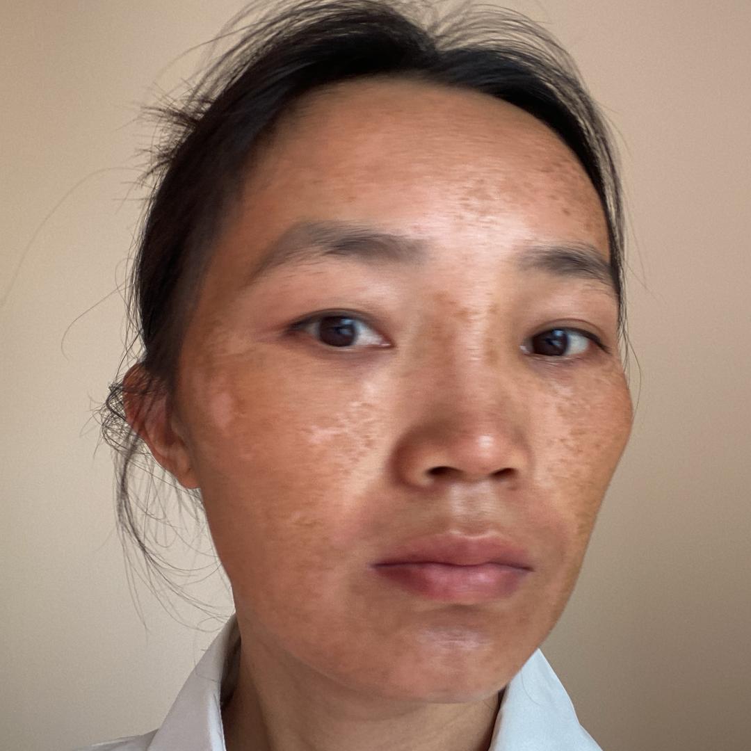 럭 키