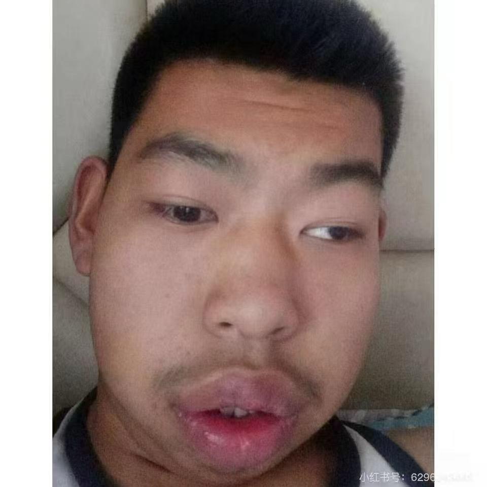 鹏鹏•麦阳