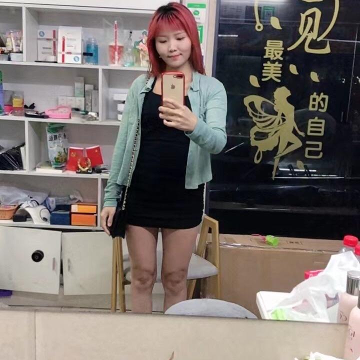 悦琪