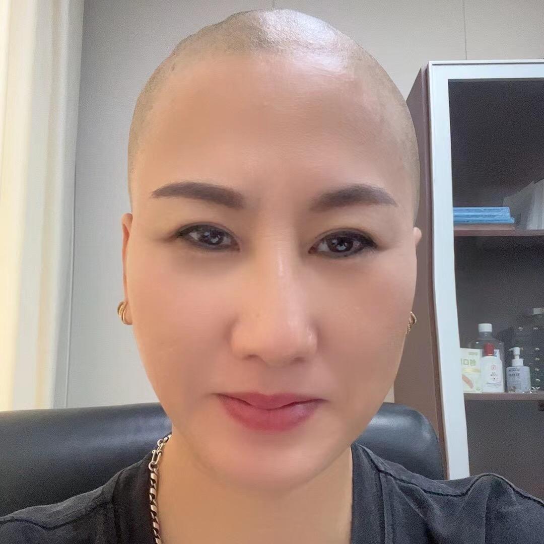 光头姐养发