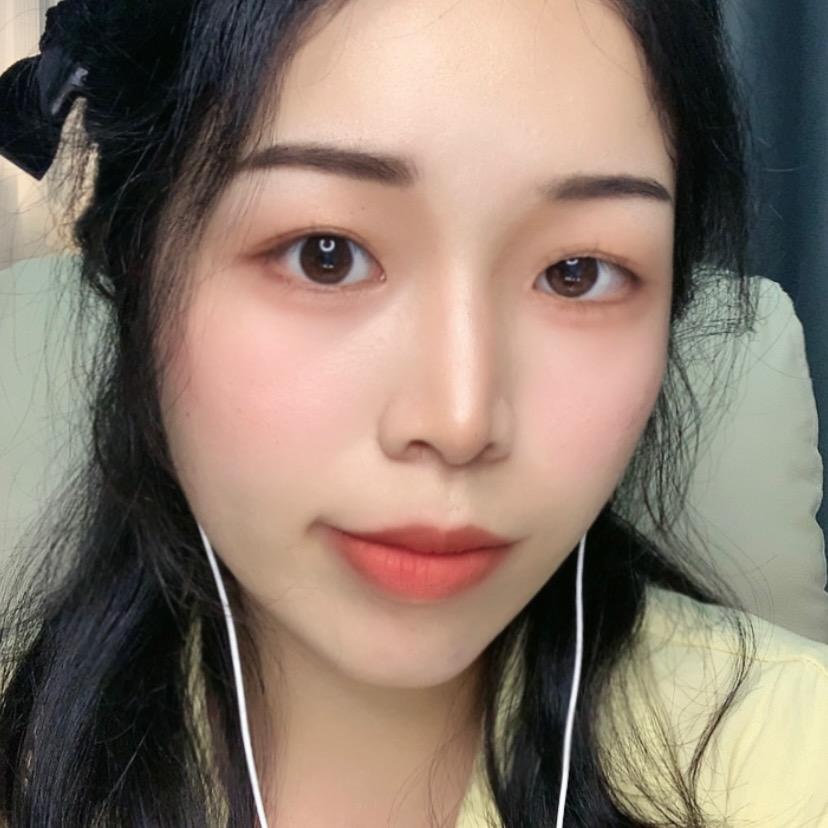 阿慧慧
