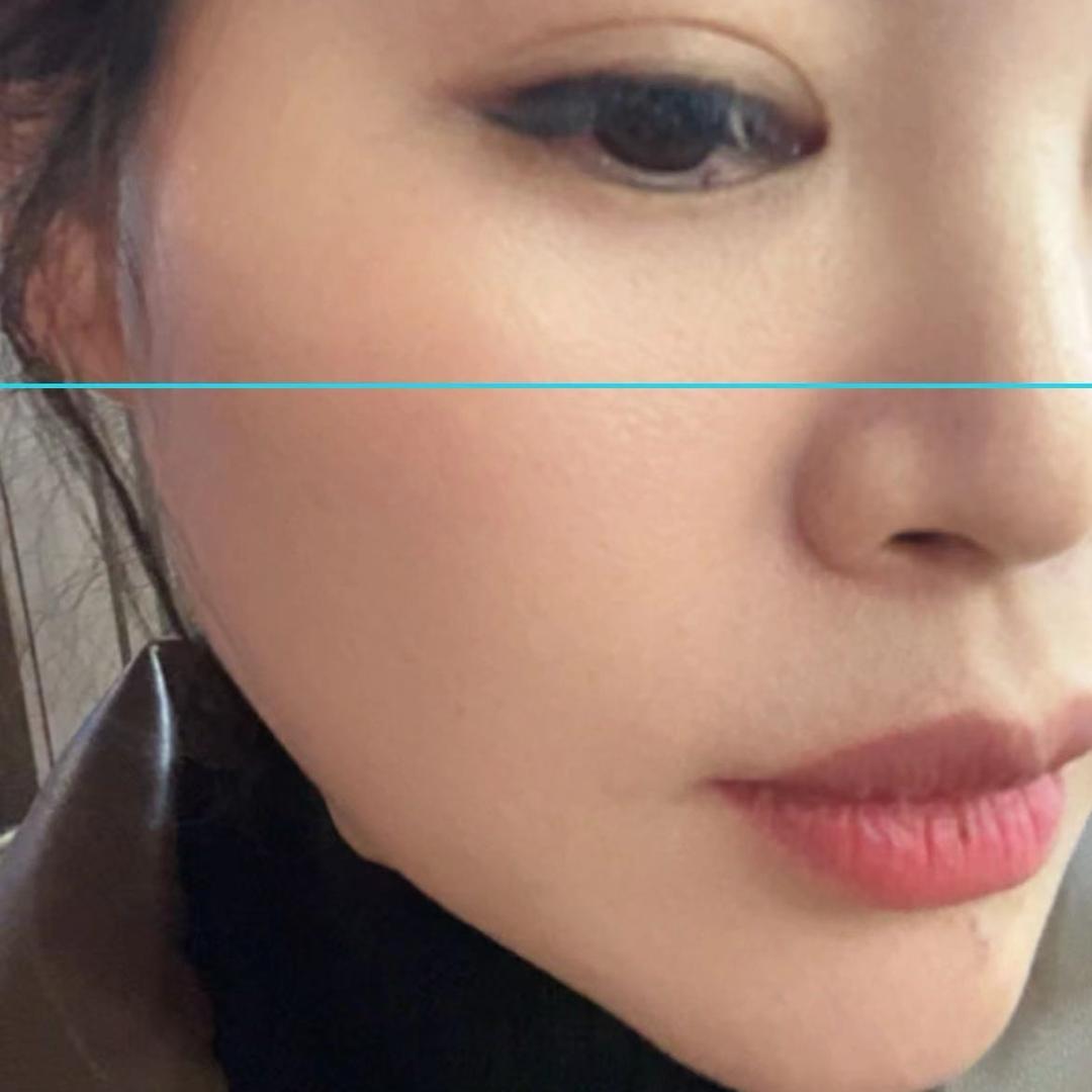 常熟下斑斑的微微