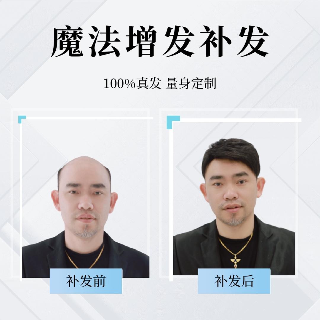 常宁补发王子 丨假发定制