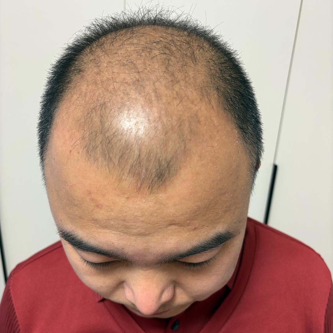 松松养发分享