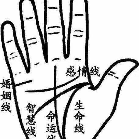 蒜-罫-师