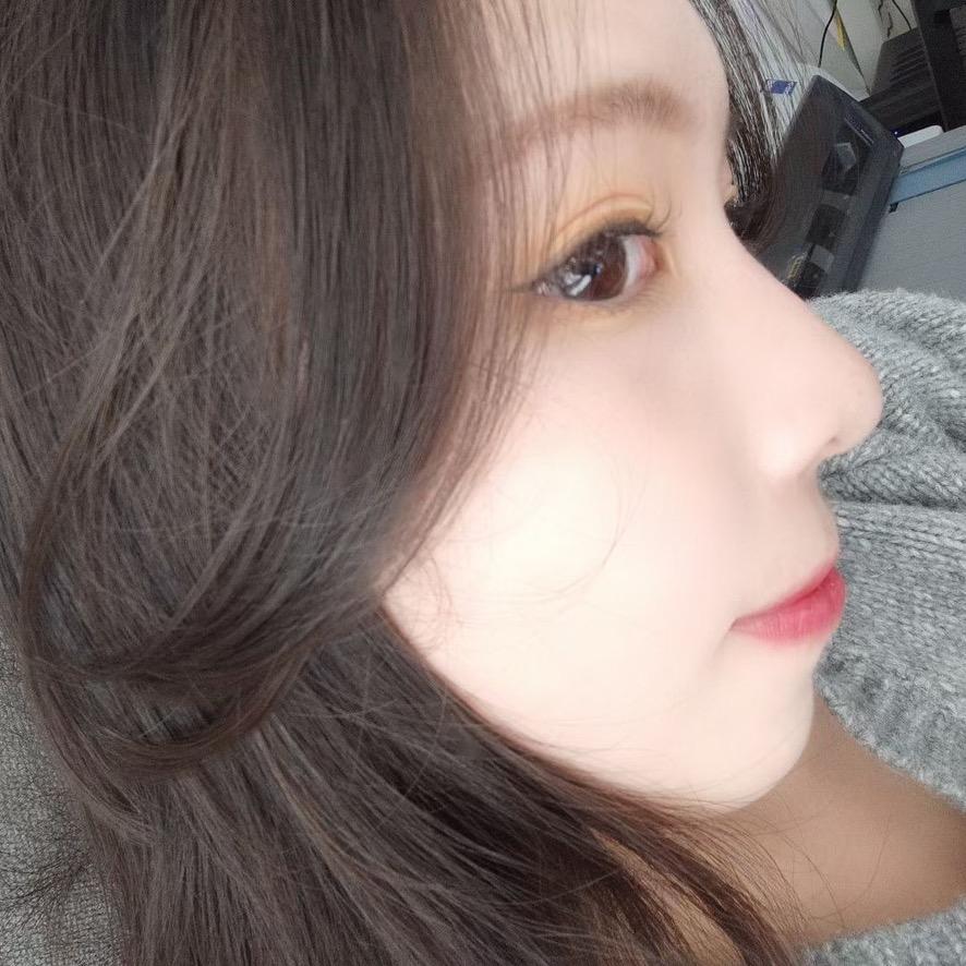 小 美