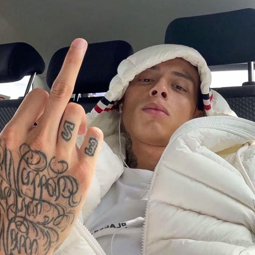 $