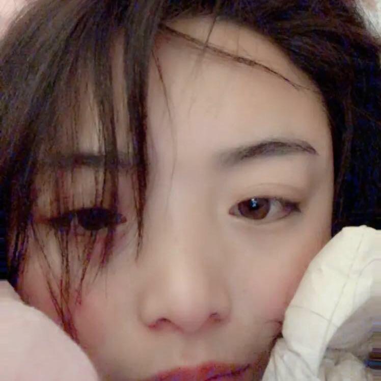 阿美