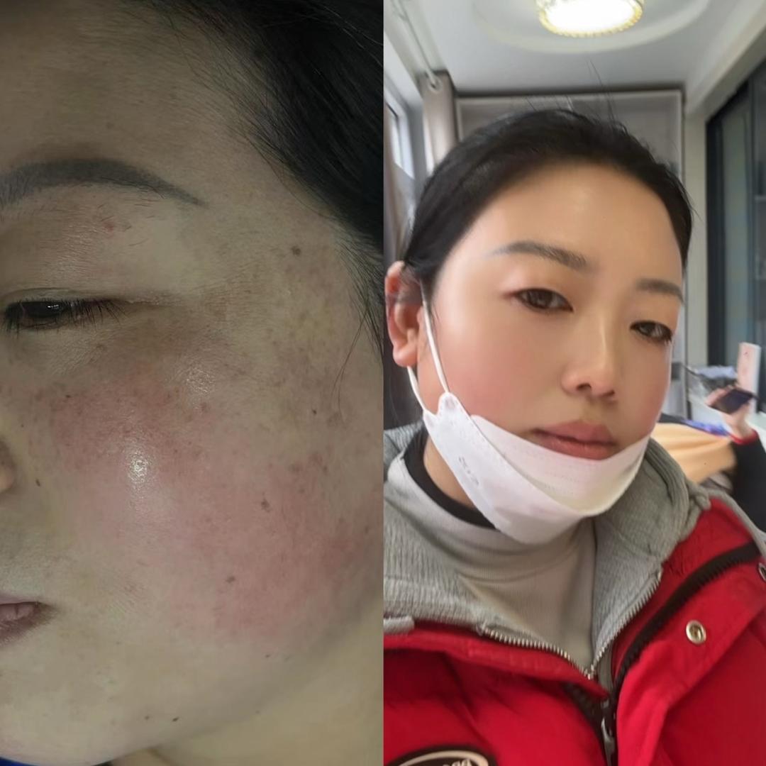 美业金姐皮肤管理