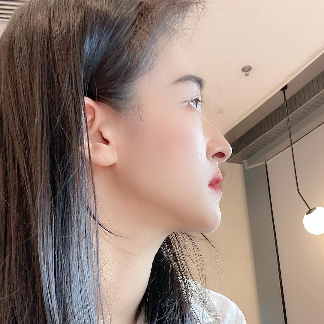 小、张一