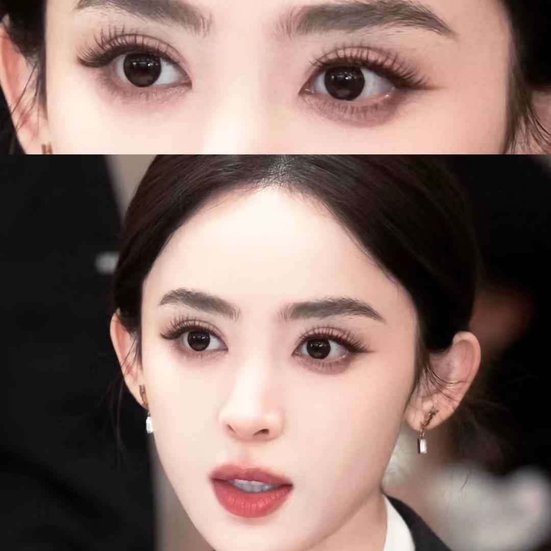 🌸鹿邑做双眼皮