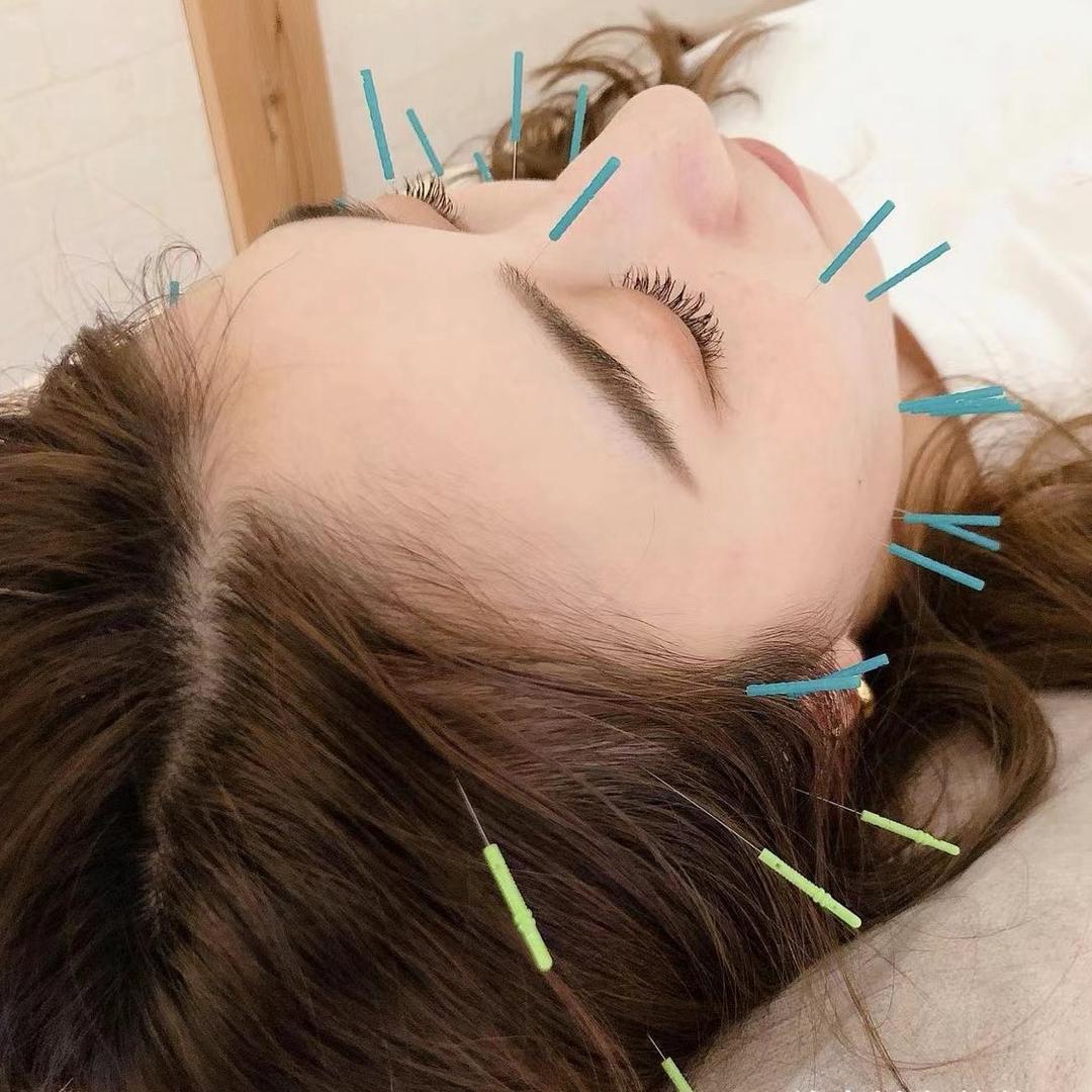 日式鍼灸美容