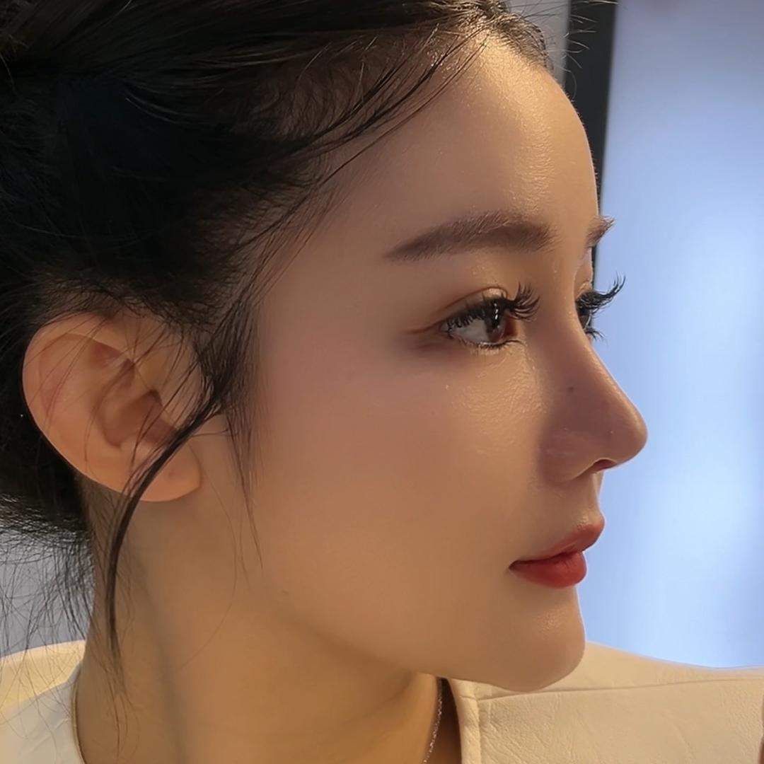 刘妍是本人1137116132变美版