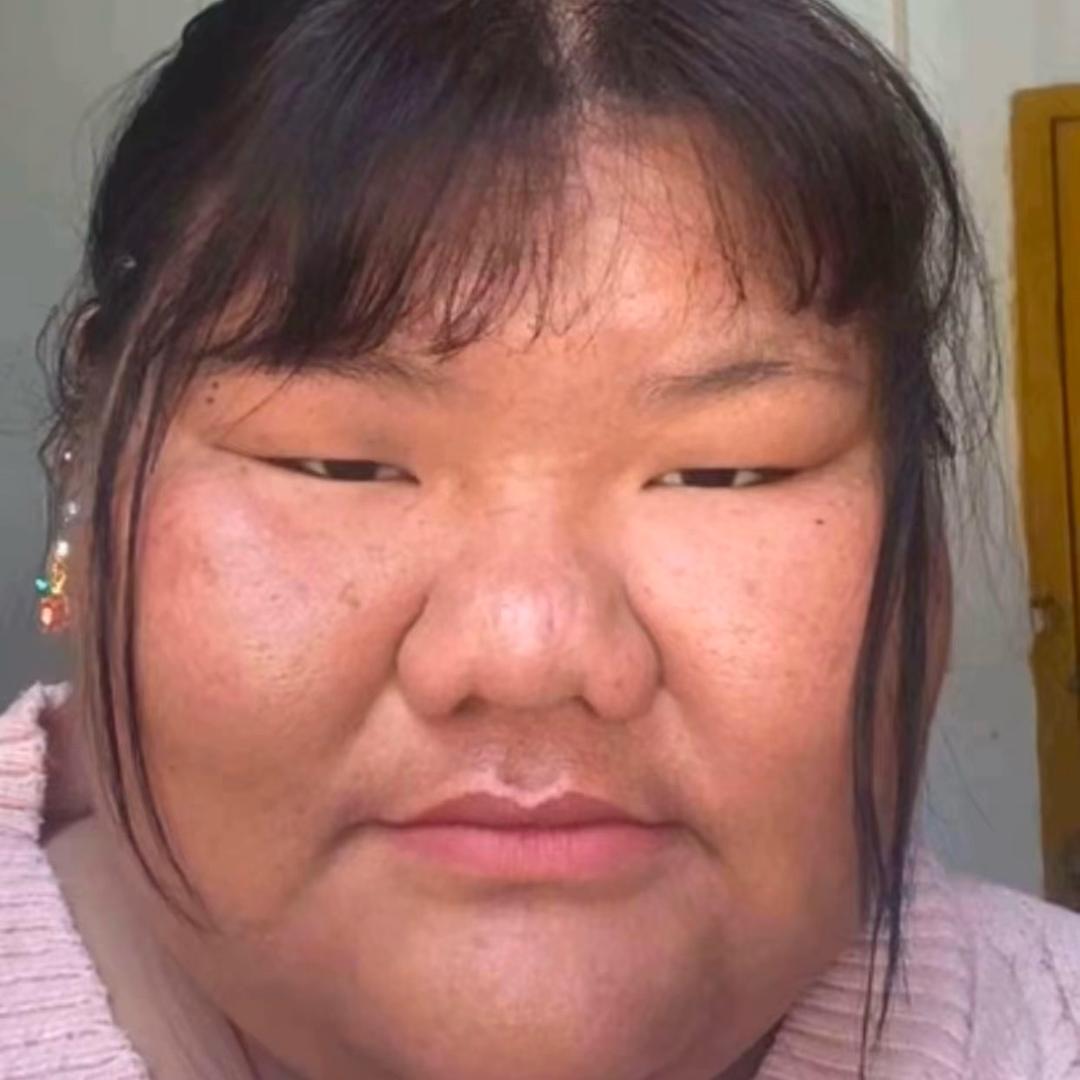 T.tongᥫᩣ