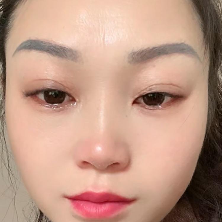 飞飞