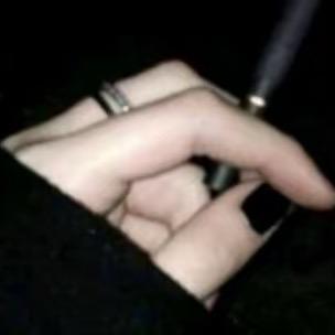 我失忆了有可能是忘掉你 怎么办