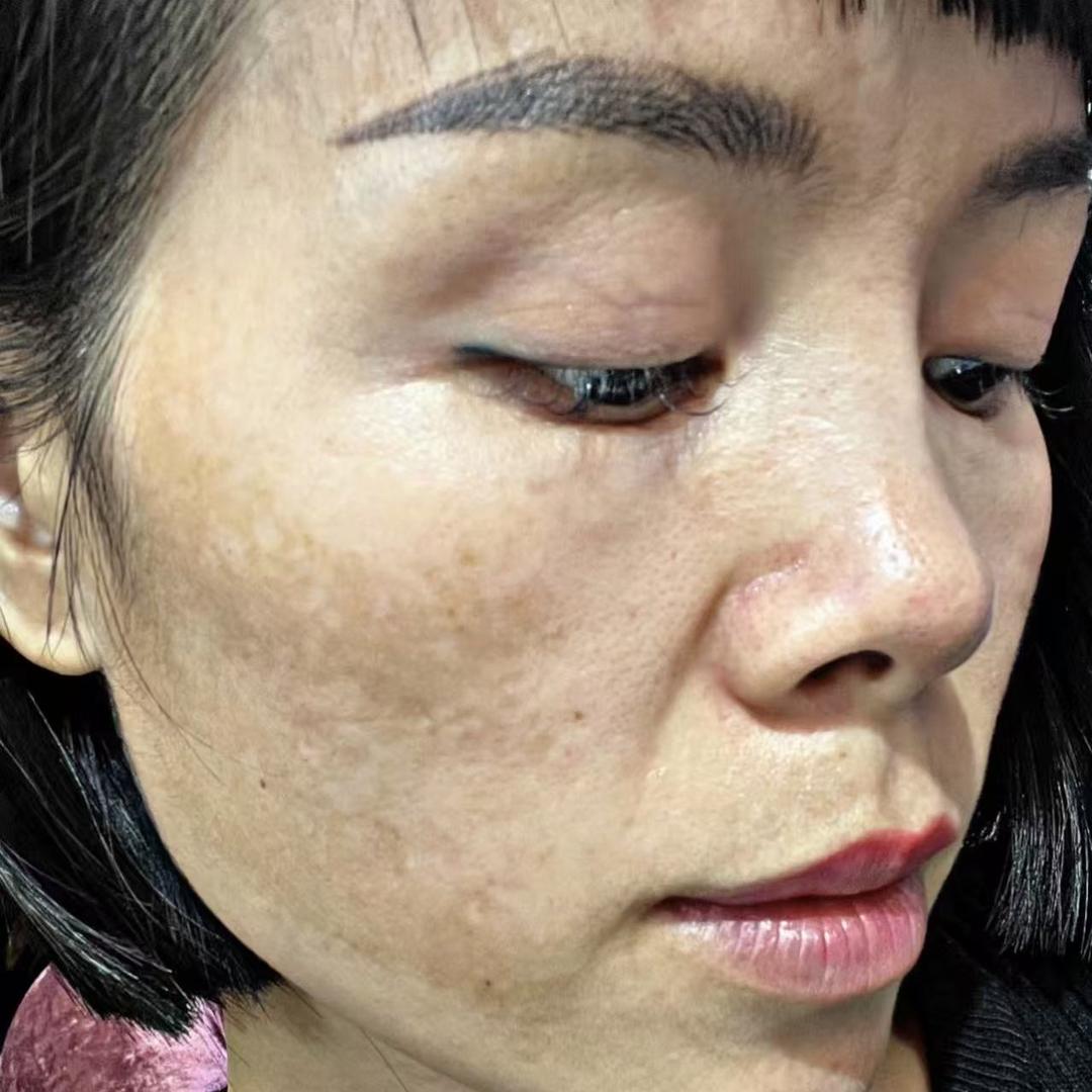 泉熙润养肤