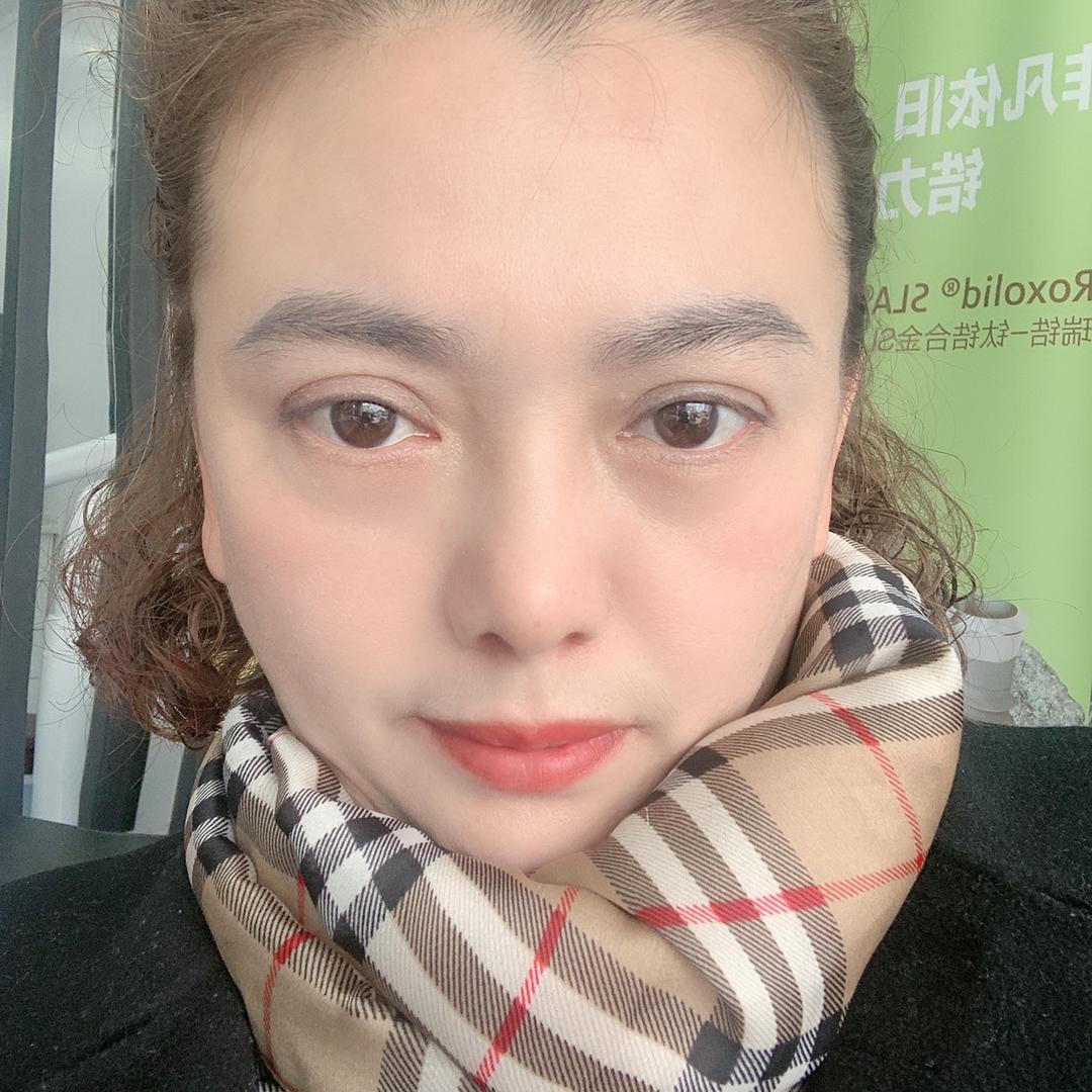 陈艳．