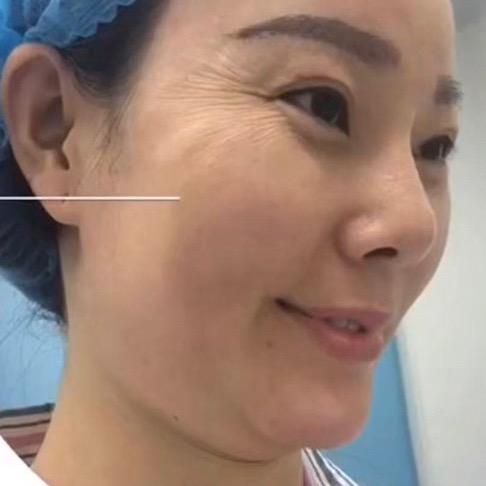 申伊童颜余院变美指导站