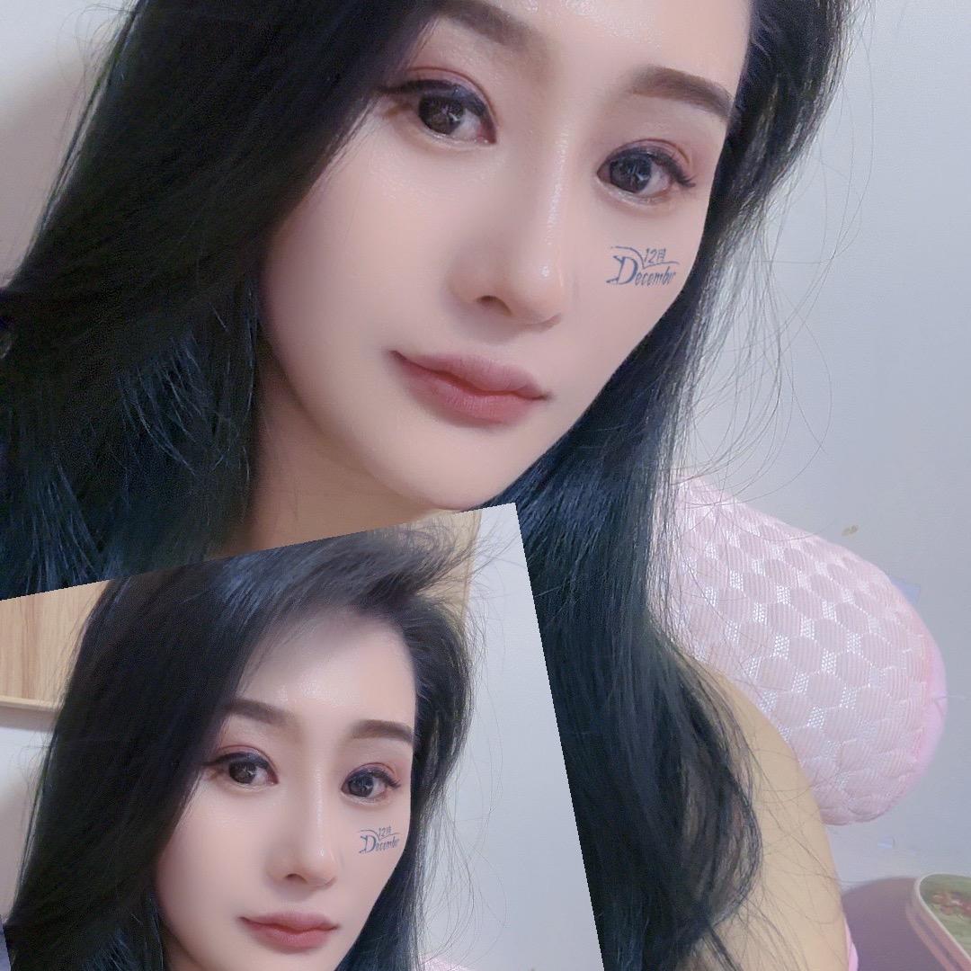 会痛的石头