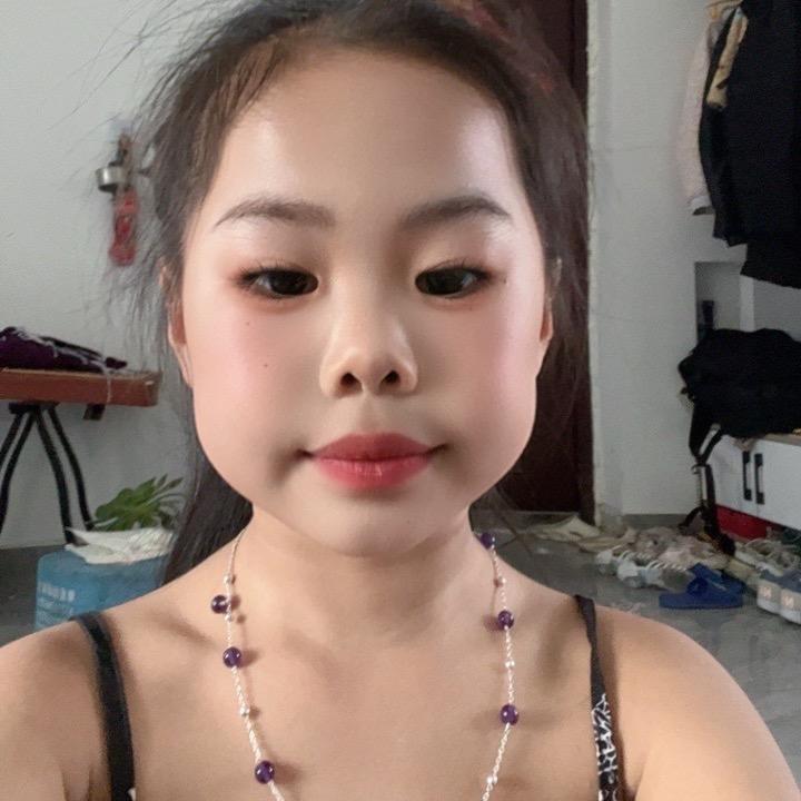 刘绍敏《烧伤》