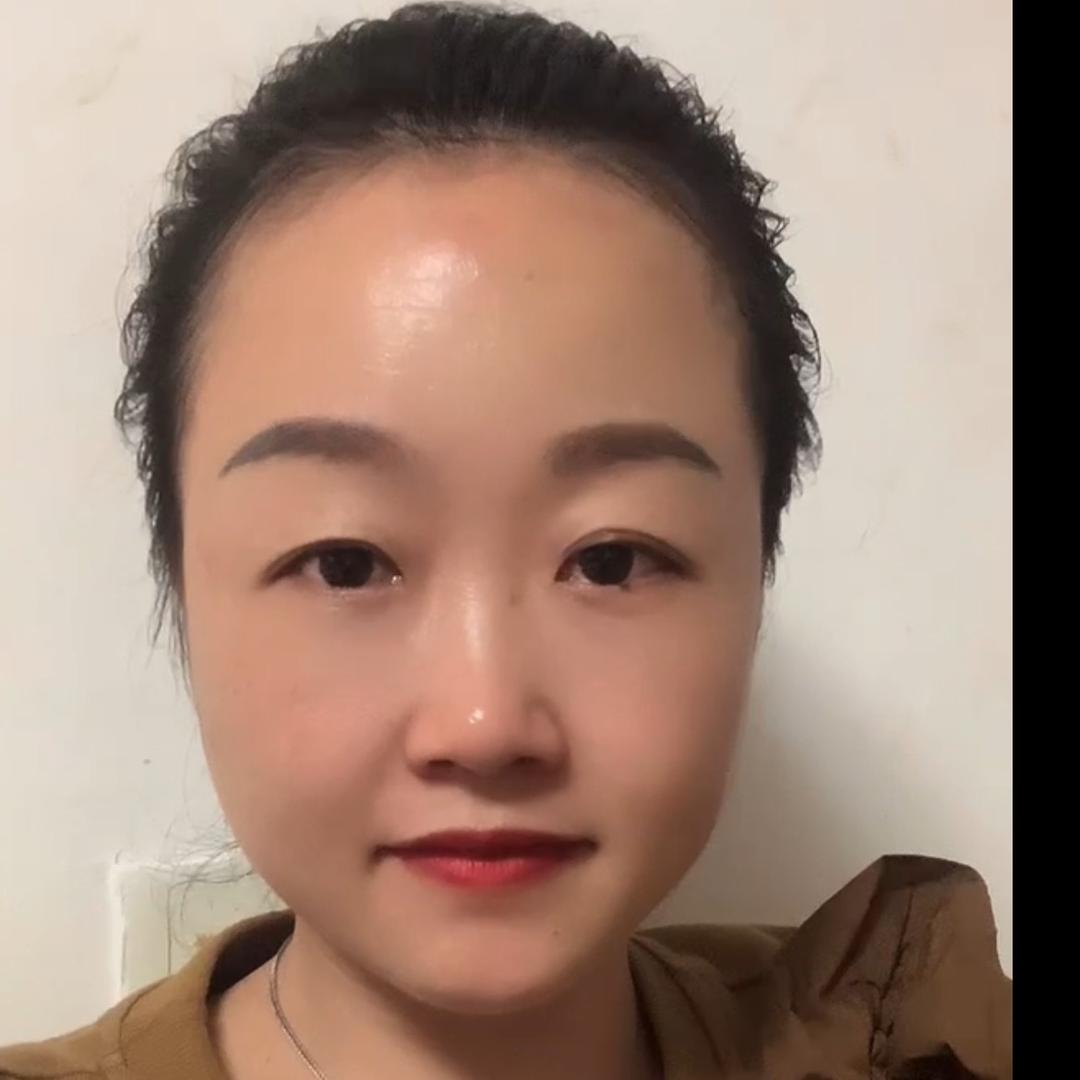 张丽🎈
