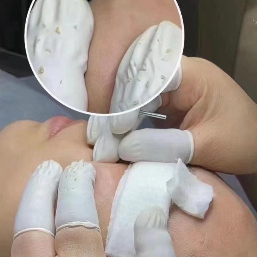 痘克宝私人会所