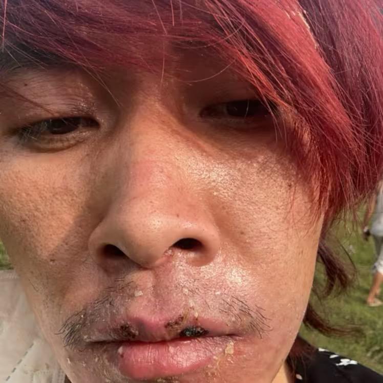 火云