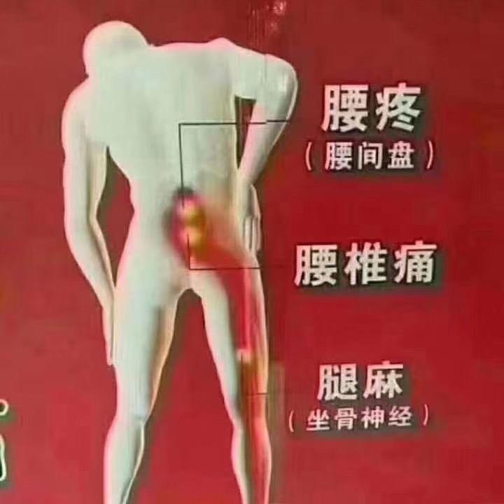 黑乔膏药