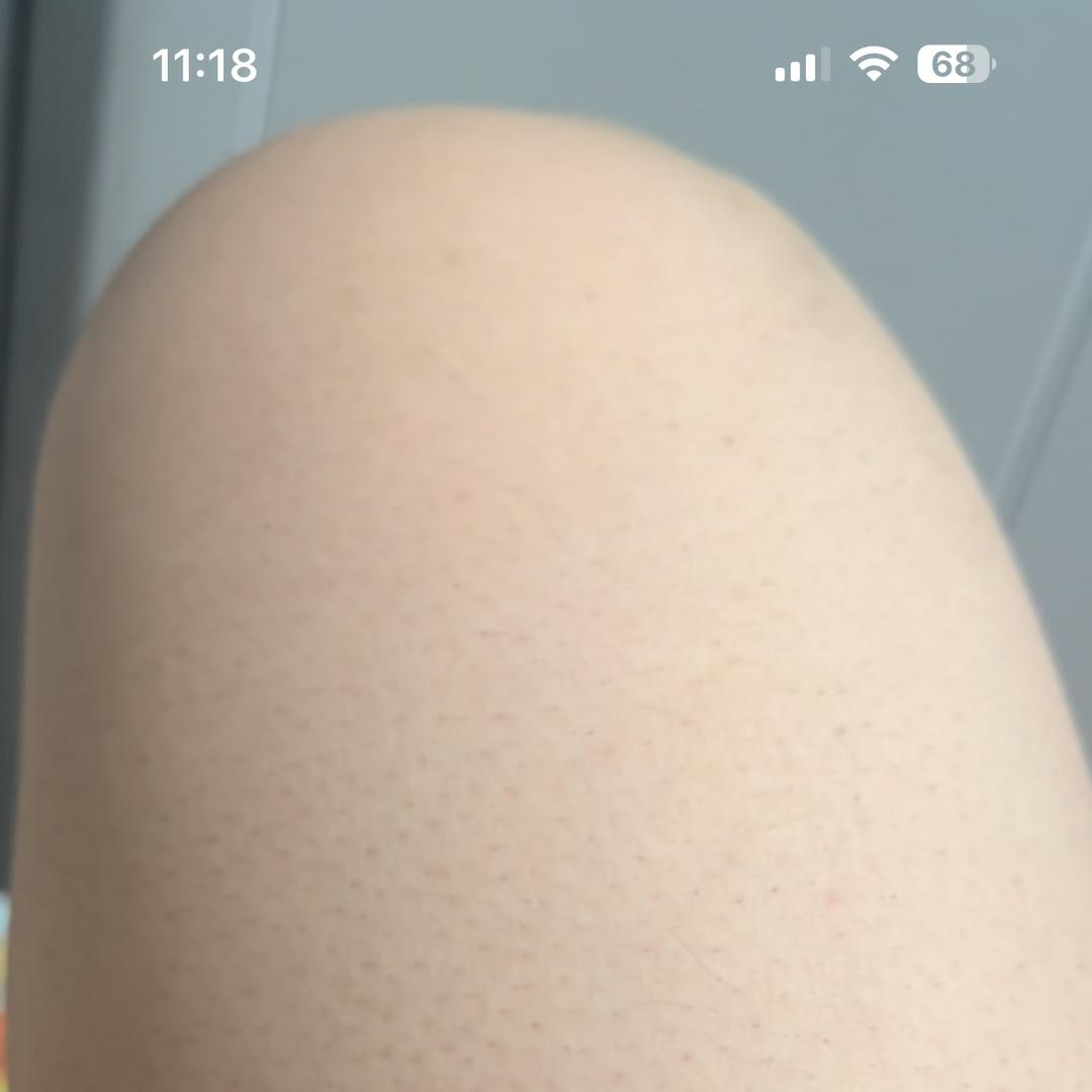 昆