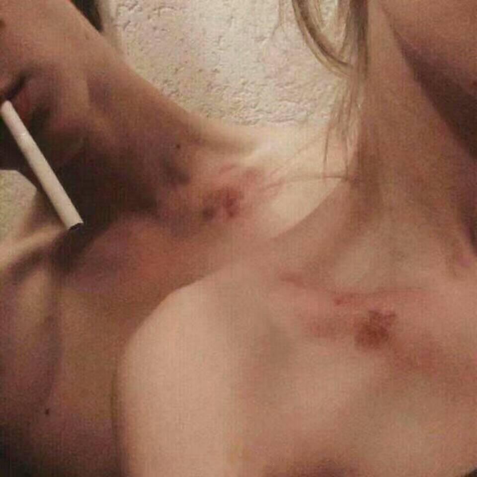 0424