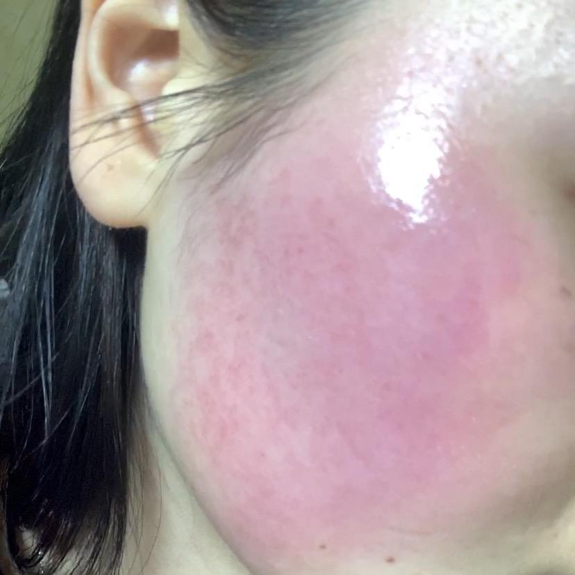 小喇叭📣脸红