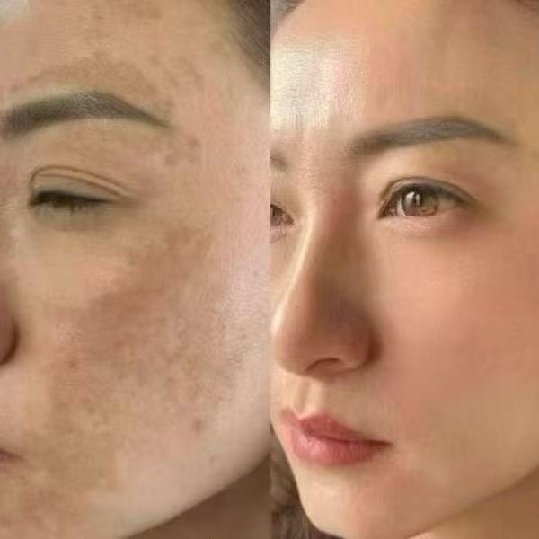 碧湖叶子美妆2