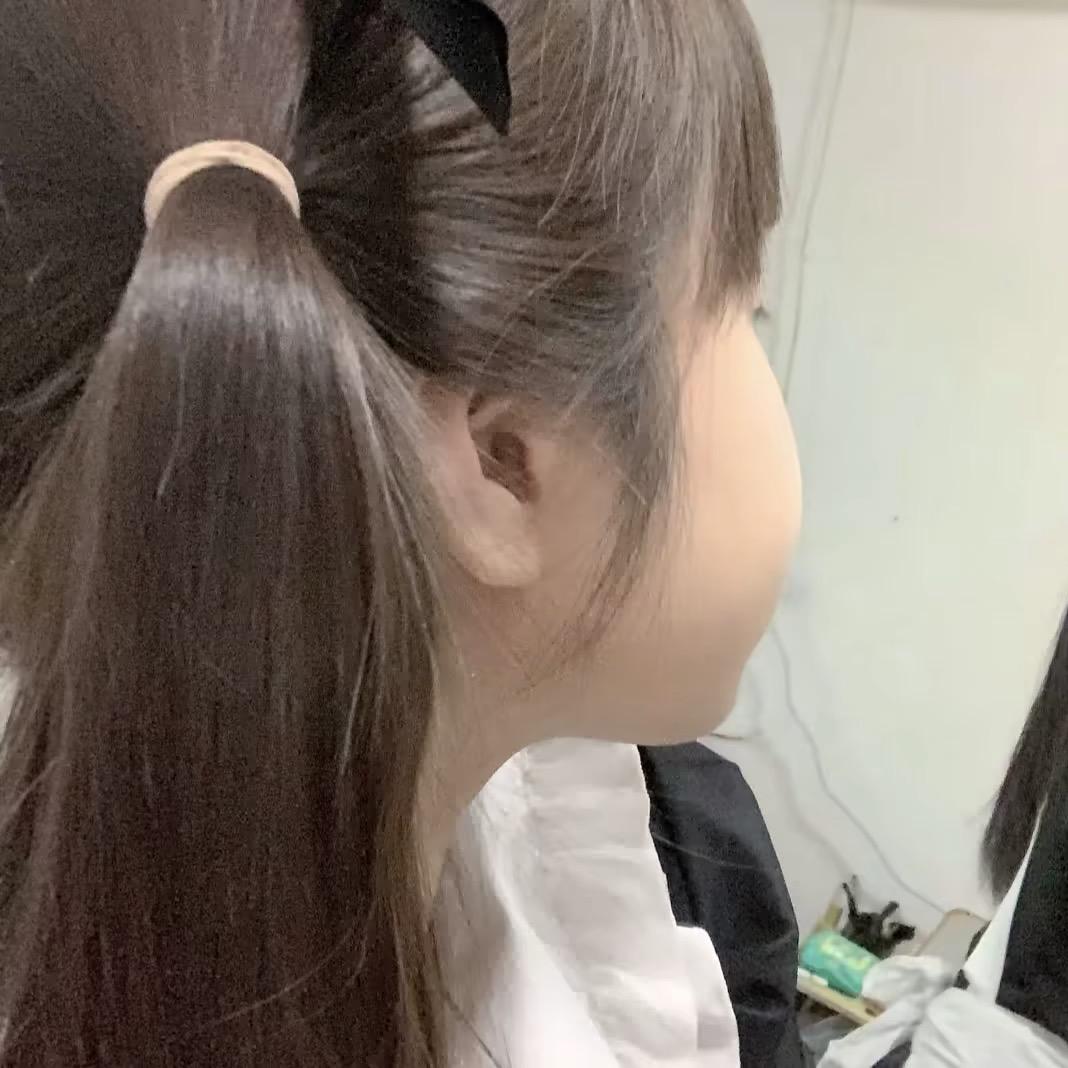 别咬我
