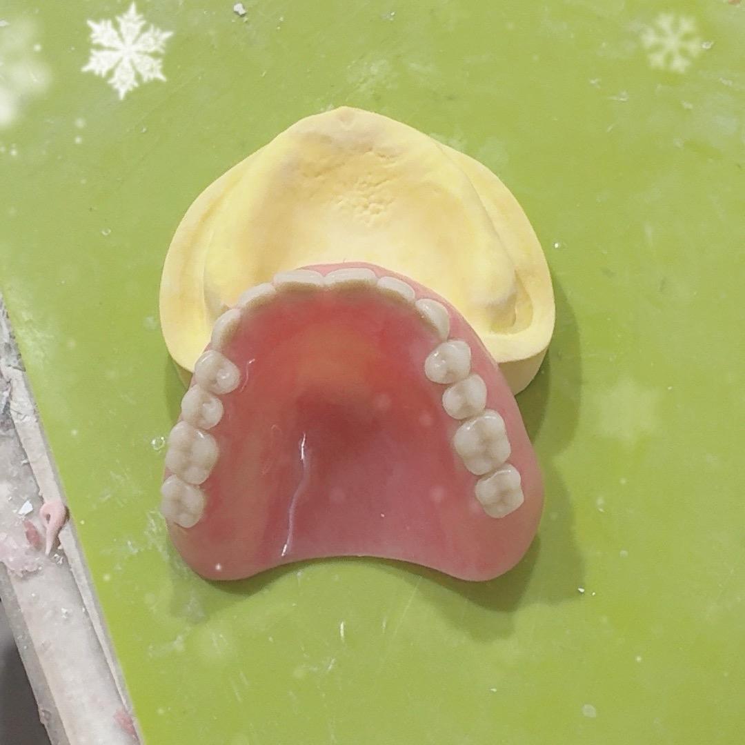 山西大同吸附性义齿（即刻负重）凯