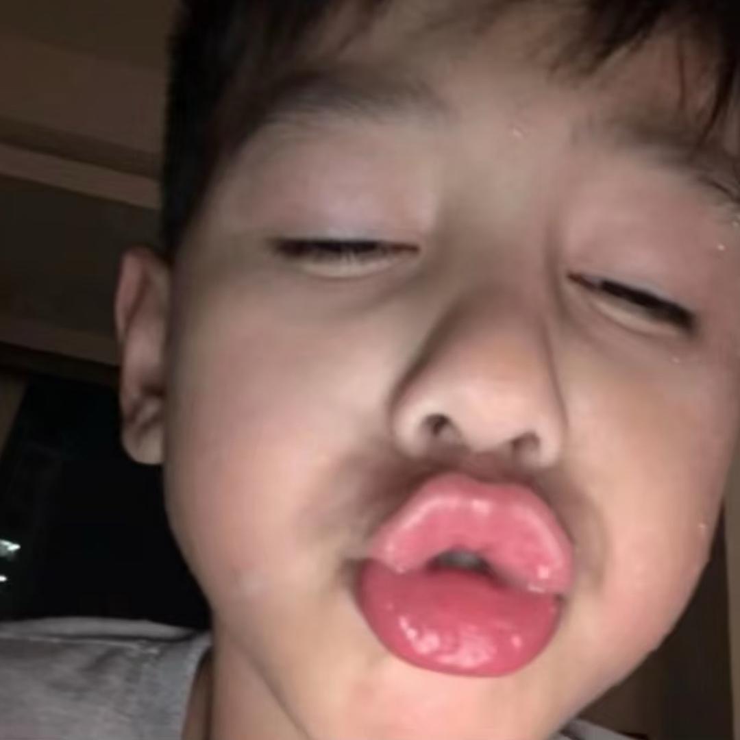 被情扎了一万针