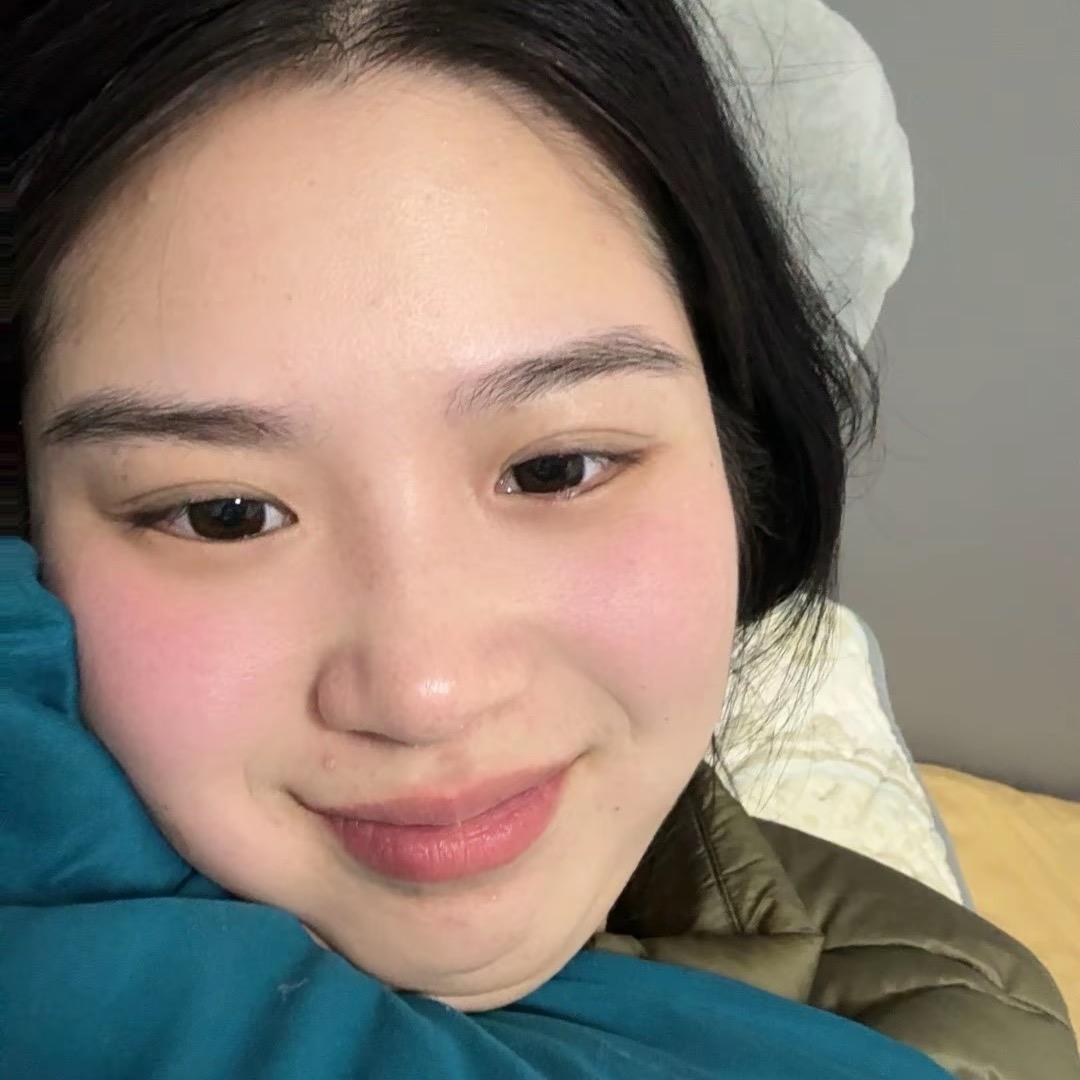 张敏