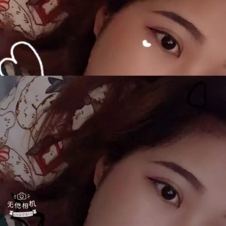 美宇