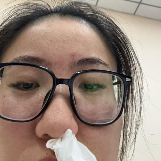 花花的鼻敏舒缓实录