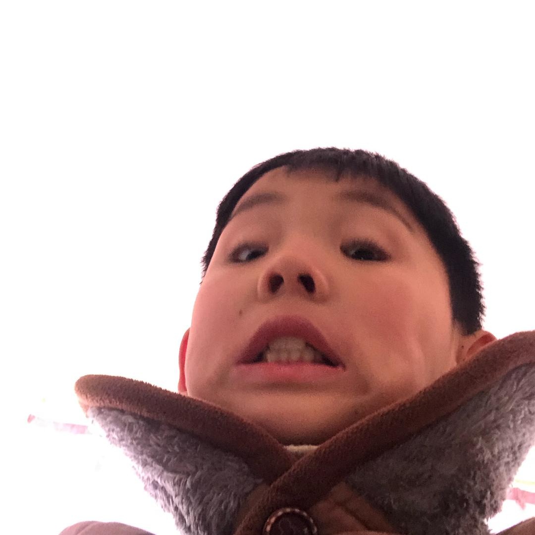 FT