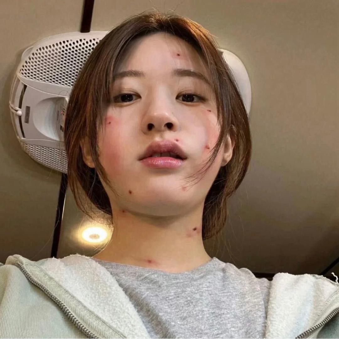 癞皮狗🦴
