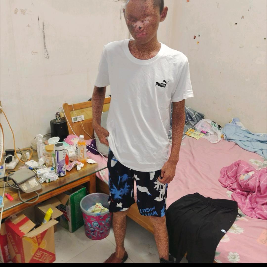 小艺。