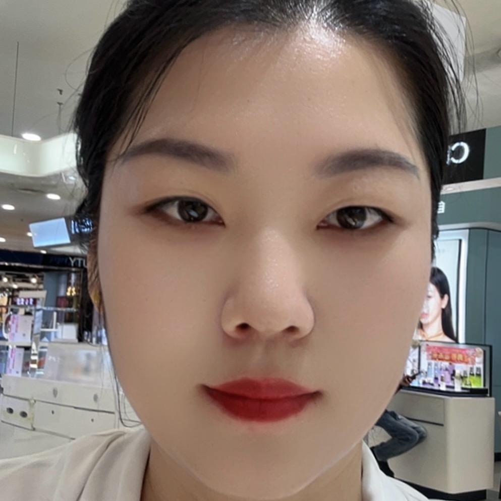 小小张