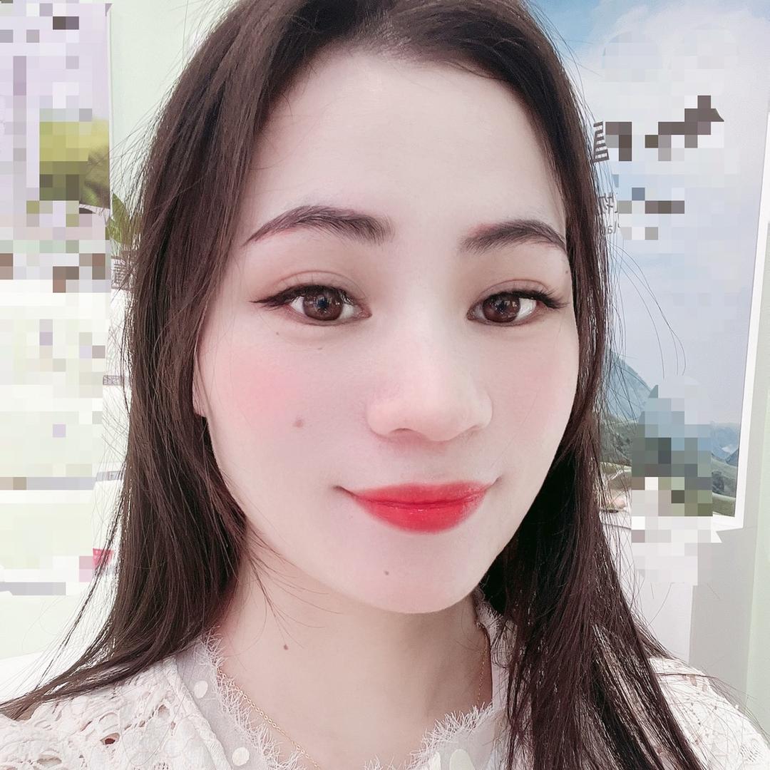 娜娜佳茵玻尿酸
