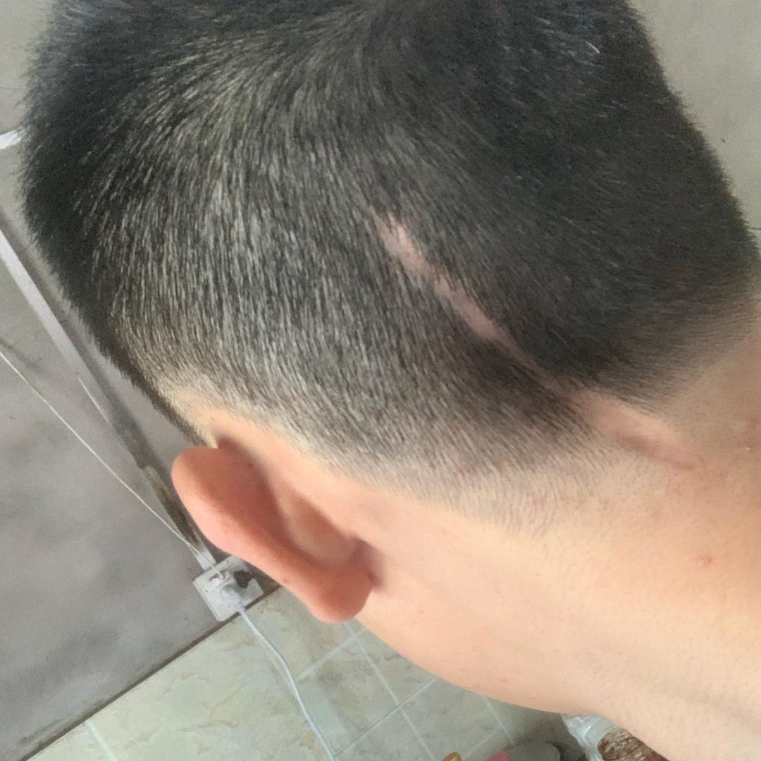 农村小陈