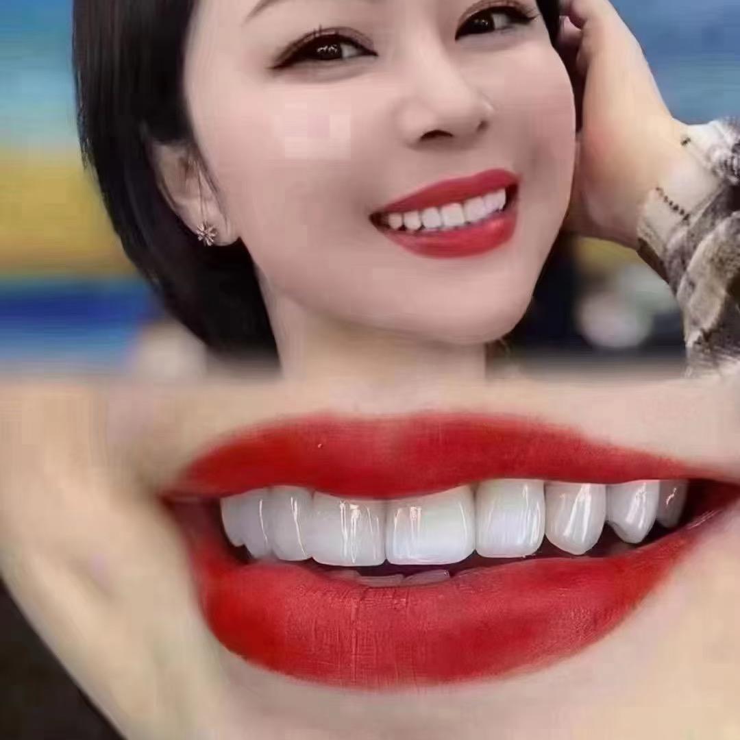 全瓷贴面加工厂