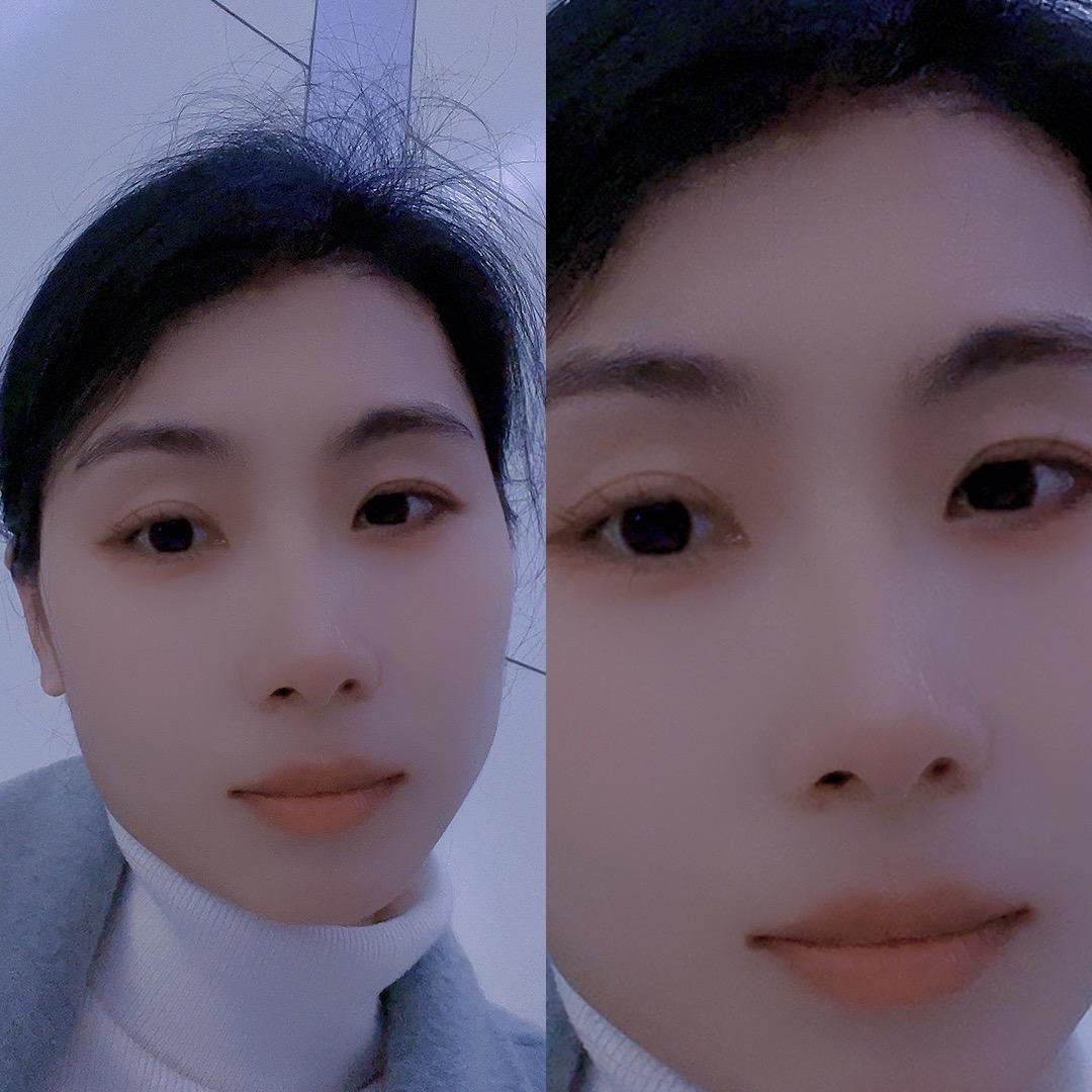 糖糖