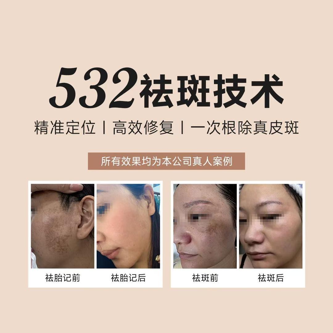 芮老师-532科学祛斑